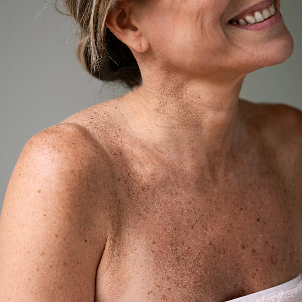 Mature Skin