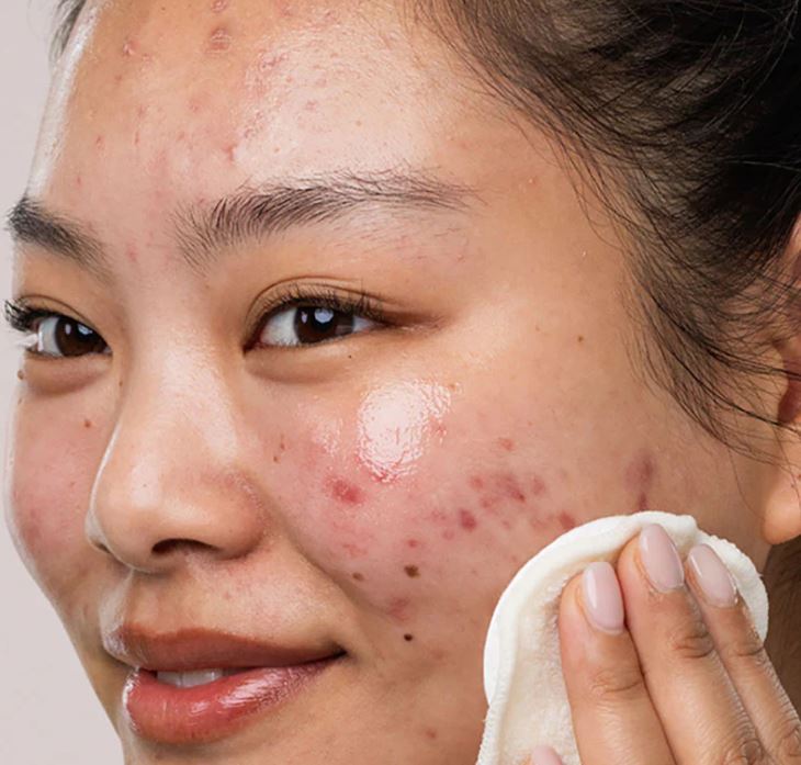 SVR SEBIACLEAR Micellar Water (spot, blemish, oily-prone skin) - Travel Size (75ml)